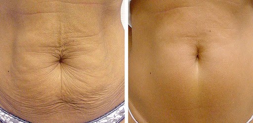 Resultados de María